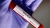 Un test de coronavirus