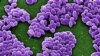 Սիբիրախտի հարուցիչը՝ Bacillus anthracis