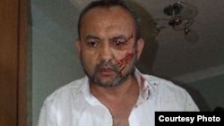 Бахром Хамраев и ранее подвергался нападениям со стороны неизвестных лиц и сотрудников российских спецслужб.