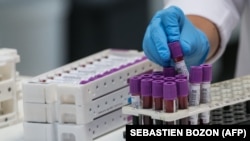 Teste pentru depistarea coronavirusului