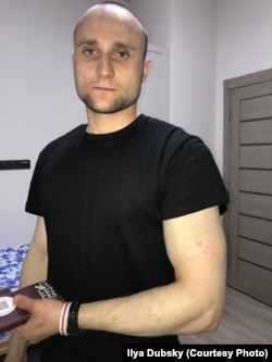 Rana na lijevoj ruci Ilije Dubskog jasno je vidljiva.