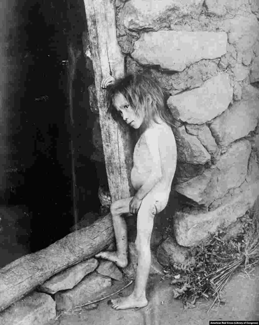 Голодающая 7-летняя девочка в Самарской области в 1921 году. Гражданская война заканчивалась, но экономика страны рухнула, урожая не было и из-за военных действий, и из-за засухи. А из-за политики &quot;военного коммунизма&quot;, которая разрешала насильственное изъятие зерна у крестьян, миллионы были охвачены голодом 